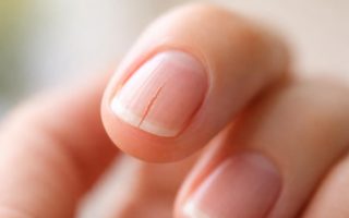 main-ongle-fendu-flou-lumiere-naturelle