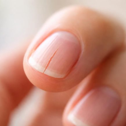 main-ongle-fendu-flou-lumiere-naturelle