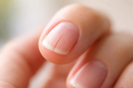 main-ongle-fendu-flou-lumiere-naturelle